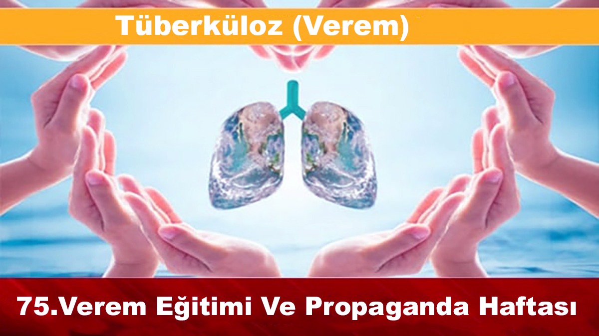 İçerikle ilgili görsel 1